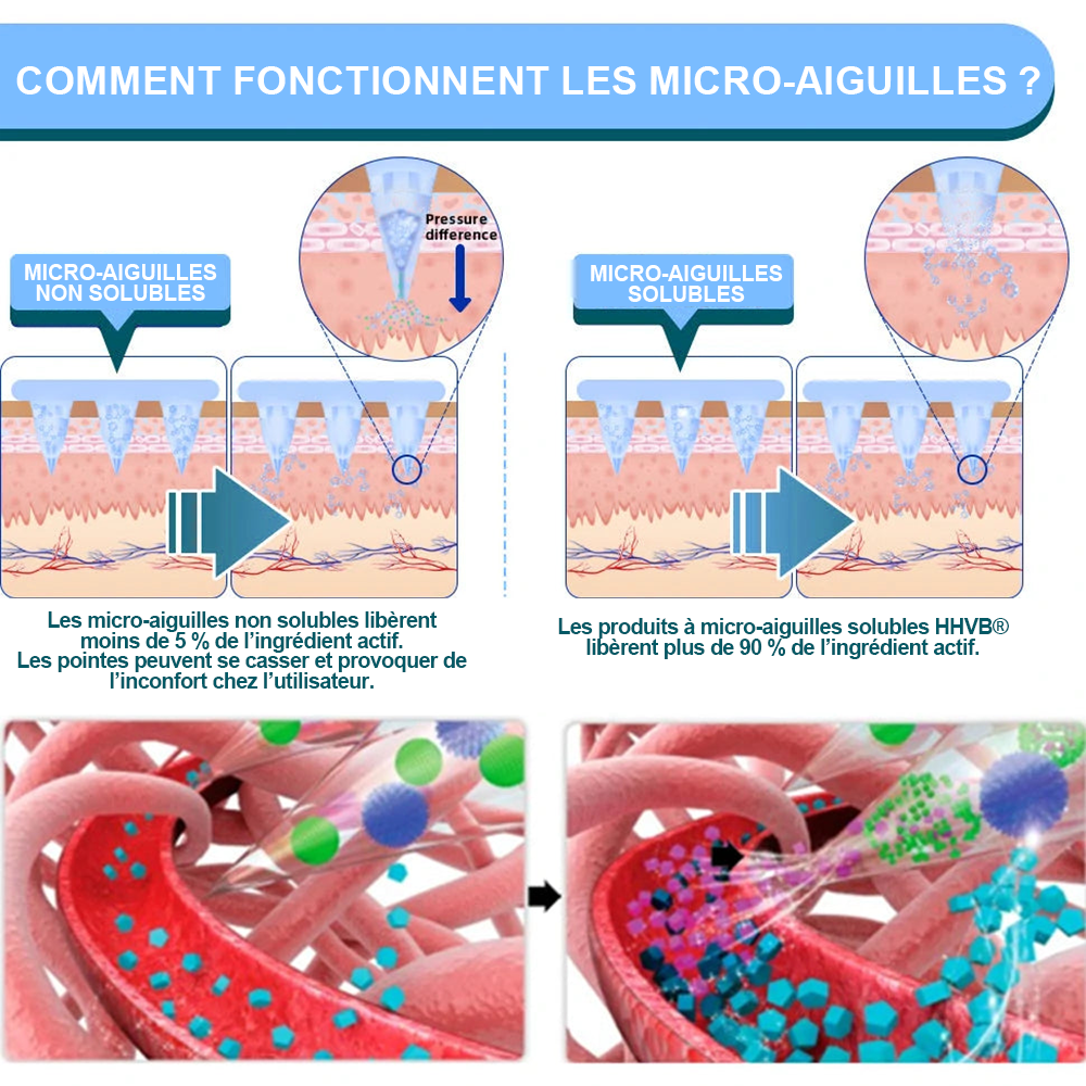 【Dernier jour de promotion : 70 % de réduction🏆🔥】𝐇𝑯𝑽𝐁® Patch à microneedles nano NIDDK-Tirzépatide 🔬(Zéro douleur, soulagement 24h/24 et 7j/7 | Perdez 9 kg RAPIDEMENT | 90 % de réduction de sucre