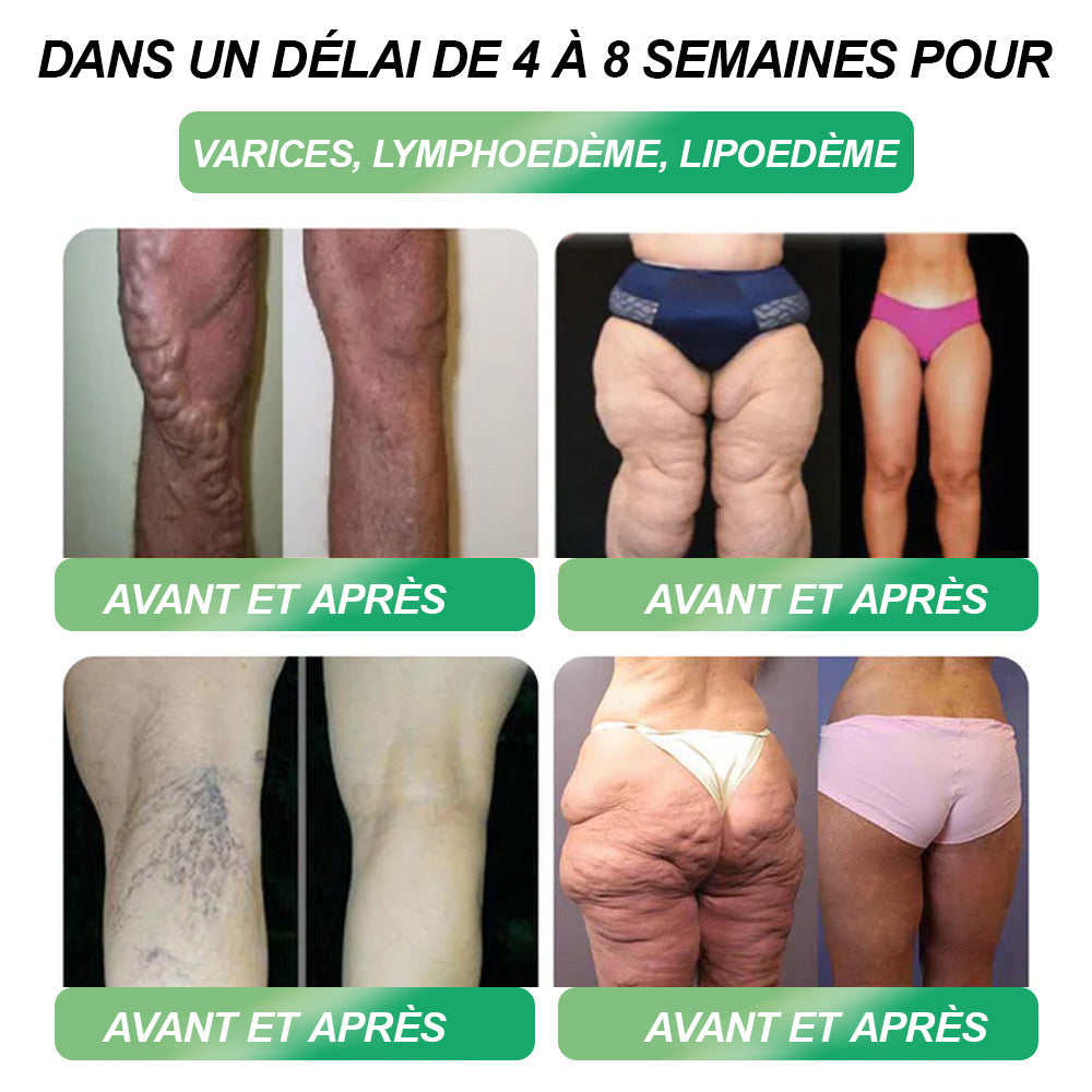 𝑳𝒊𝒈𝒖𝒆 𝒄𝒐𝒏𝒕𝒓𝒆 𝒍’𝑶𝒃é𝒔𝒊𝒕é 𝒓𝒆𝒄𝒐𝒎𝒎𝒂𝒏𝒅𝒆💎🧑‍⚕️ 𝒍𝒂 𝒔𝒐𝒍𝒖𝒕𝒊𝒐𝒏 𝒐𝒓𝒂𝒍𝒆 𝑯𝑯𝑽𝑩® 𝑮𝑳𝑷-1 𝒑𝒐𝒖𝒓 𝒍𝒂 𝒑𝒆𝒓𝒕𝒆 𝒅𝒆 𝒑𝒐𝒊𝒅𝒔 – 💫 𝑶𝒃é𝒔𝒊𝒕é, 𝒎𝒂𝒍𝒂𝒅𝒊𝒆𝒔 𝒄𝒂𝒓𝒅𝒊𝒐𝒗𝒂𝒔𝒄𝒖𝒍𝒂𝒊𝒓𝒆𝒔, 𝒅𝒊𝒂𝒃è𝒕𝒆, 𝒂𝒑𝒏é𝒆 𝒅𝒖 𝒔𝒐𝒎𝒎𝒆𝒊𝒍, 𝒑𝒓𝒐𝒃𝒍è𝒎𝒆𝒔 𝒂𝒓𝒕𝒊𝒄𝒖𝒍𝒂𝒊𝒓𝒆𝒔 𝒆𝒕 𝒃𝒊𝒆𝒏 𝒑𝒍𝒖𝒔 𝒆𝒏𝒄𝒐𝒓𝒆 🏆🔥